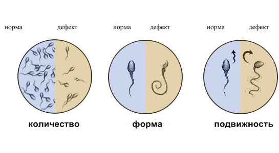 Спермограмма в Казани